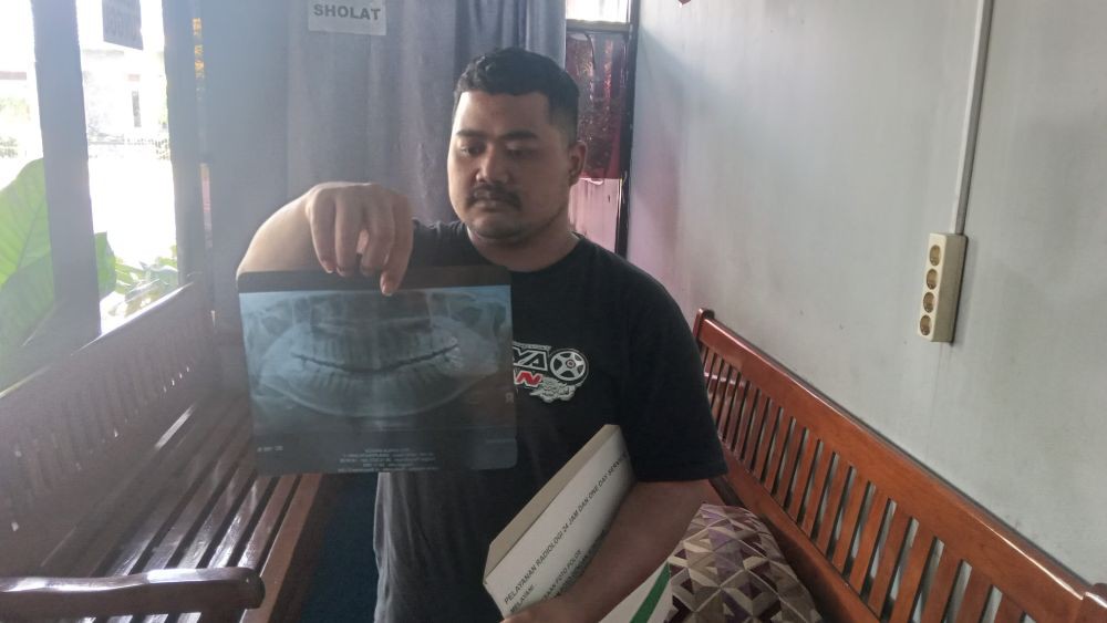 Kasus Cabut Gigi Bungsu Berujung Maut, Begini Kata Kadinkes Ngawi