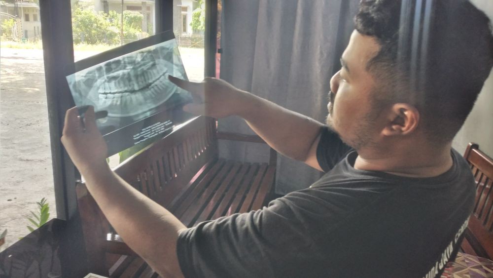 PB PDGI Investigasi Kasus Cabut Gigi Bungsu Maut di Ngawi