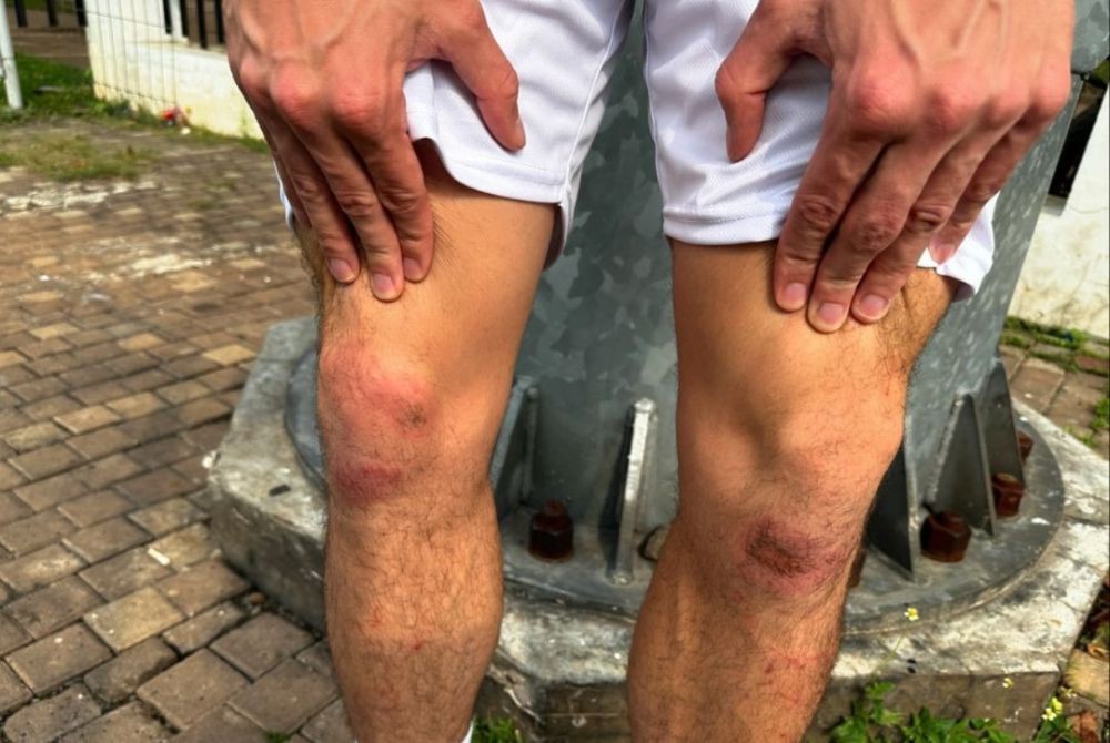 Lutut Thom Haye Bonyok Gegara Selebrasi di Rumput SUGBK 