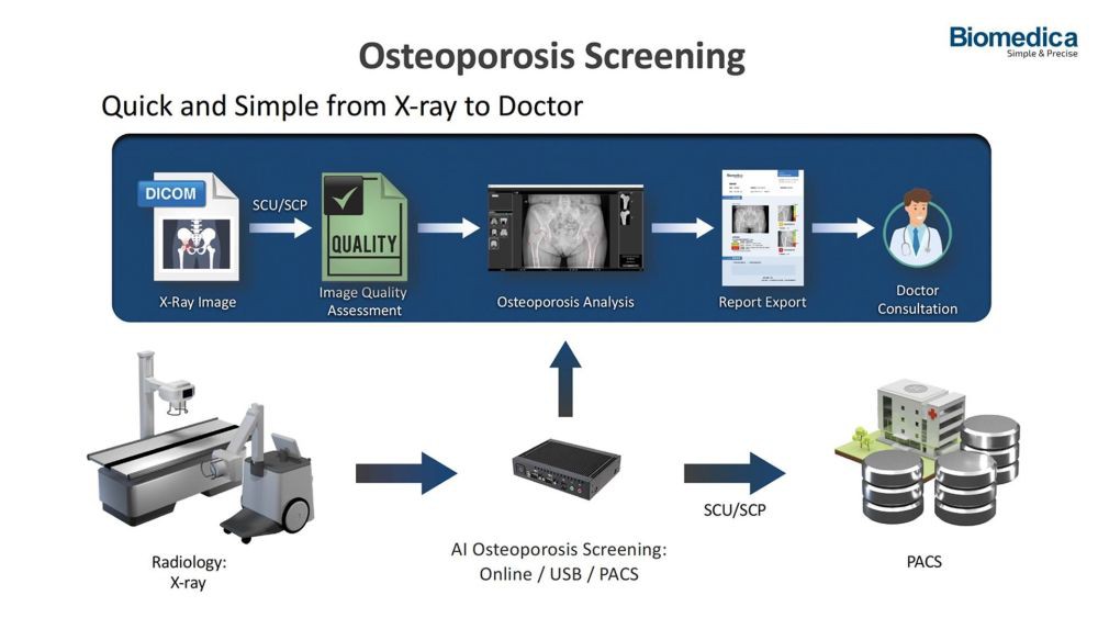 Teknologi AI OsteoCloud Mampu Deteksi Dini Gejala Osteoporosis