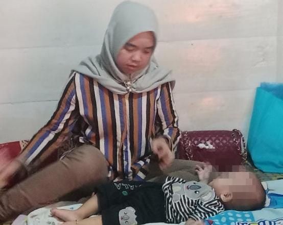 Bayi Hipospadia di Palembang Sudah Punya KIS, Pemkot Jamin Pengobatan